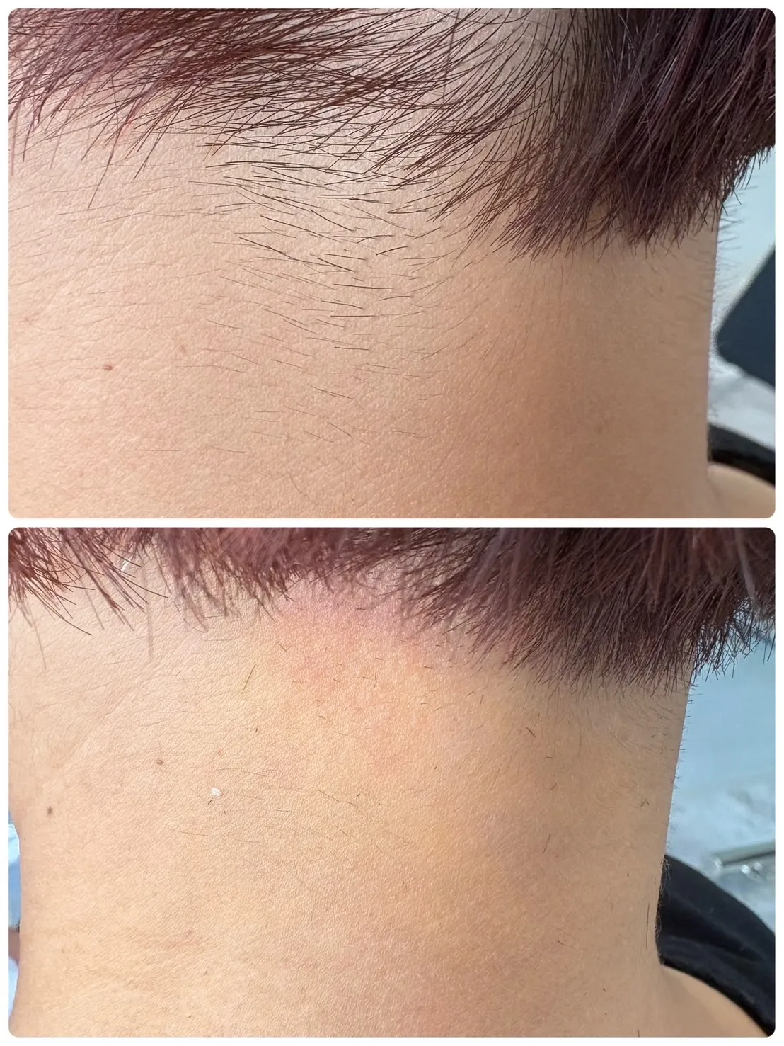 襟足WAX同時施術できます